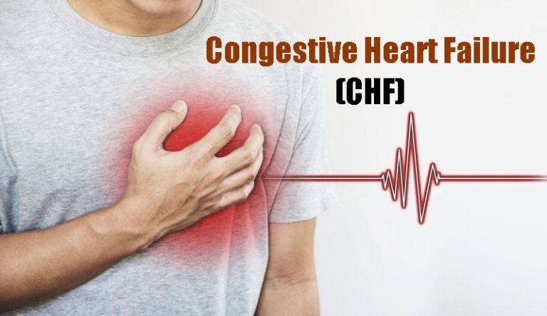 12 Congestive Heart Failure Symptoms – Causes, Diagnosis, Treatments & Preventions
