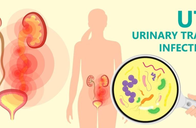 How Does a Woman Get a Urinary Tract Infection?