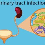 What is the Cause of Urinary Tract Infection